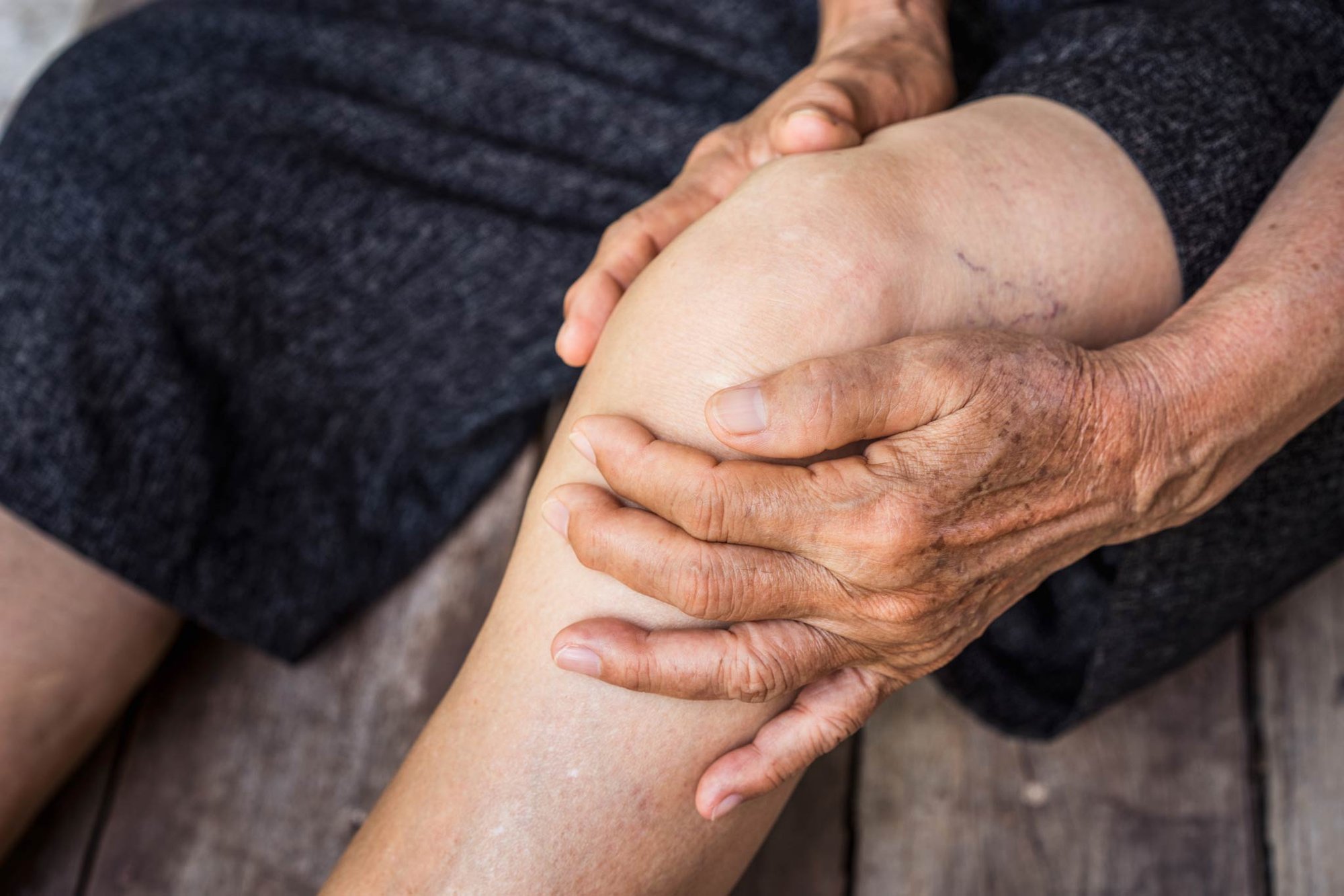 PFDM Reports - Osteoarthritis
